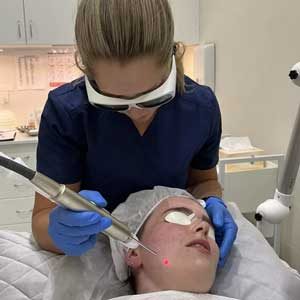 Cosmetic doctor uses Fotona laser to target deep imperfections in a patients face for facial rejuvenation